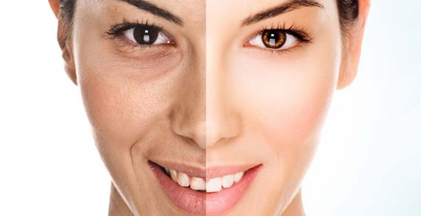 Anti-Ageing Treatment