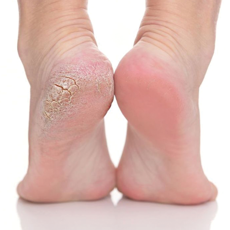 Heel Peel Pedicure Spa