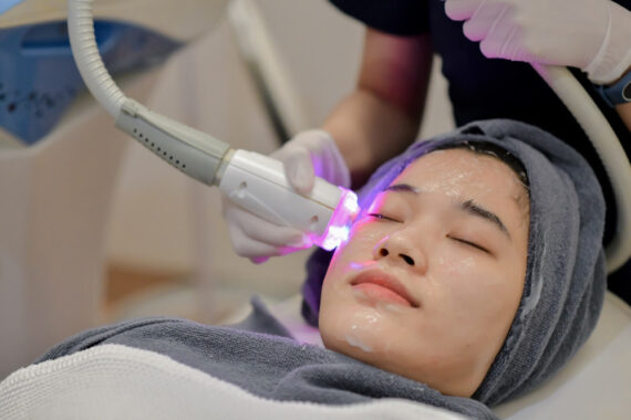Laser Anti Ageing Treatment
